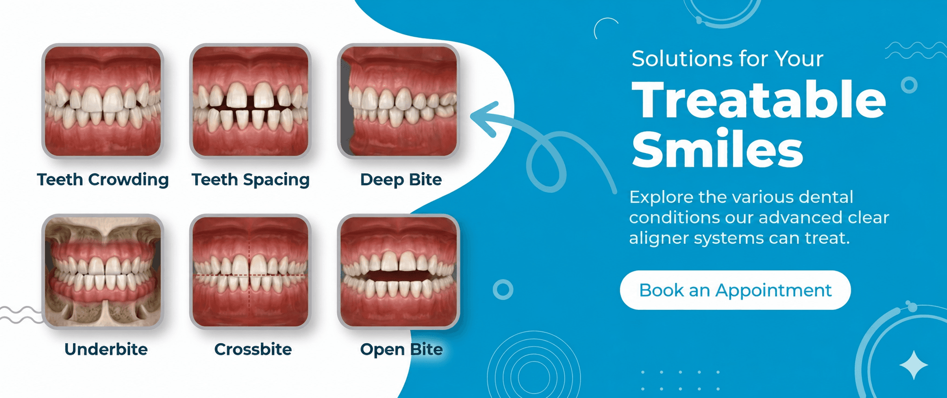Banner 2 for treatable smiles