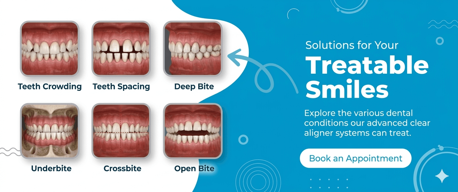 Banner 2 for treatable smiles