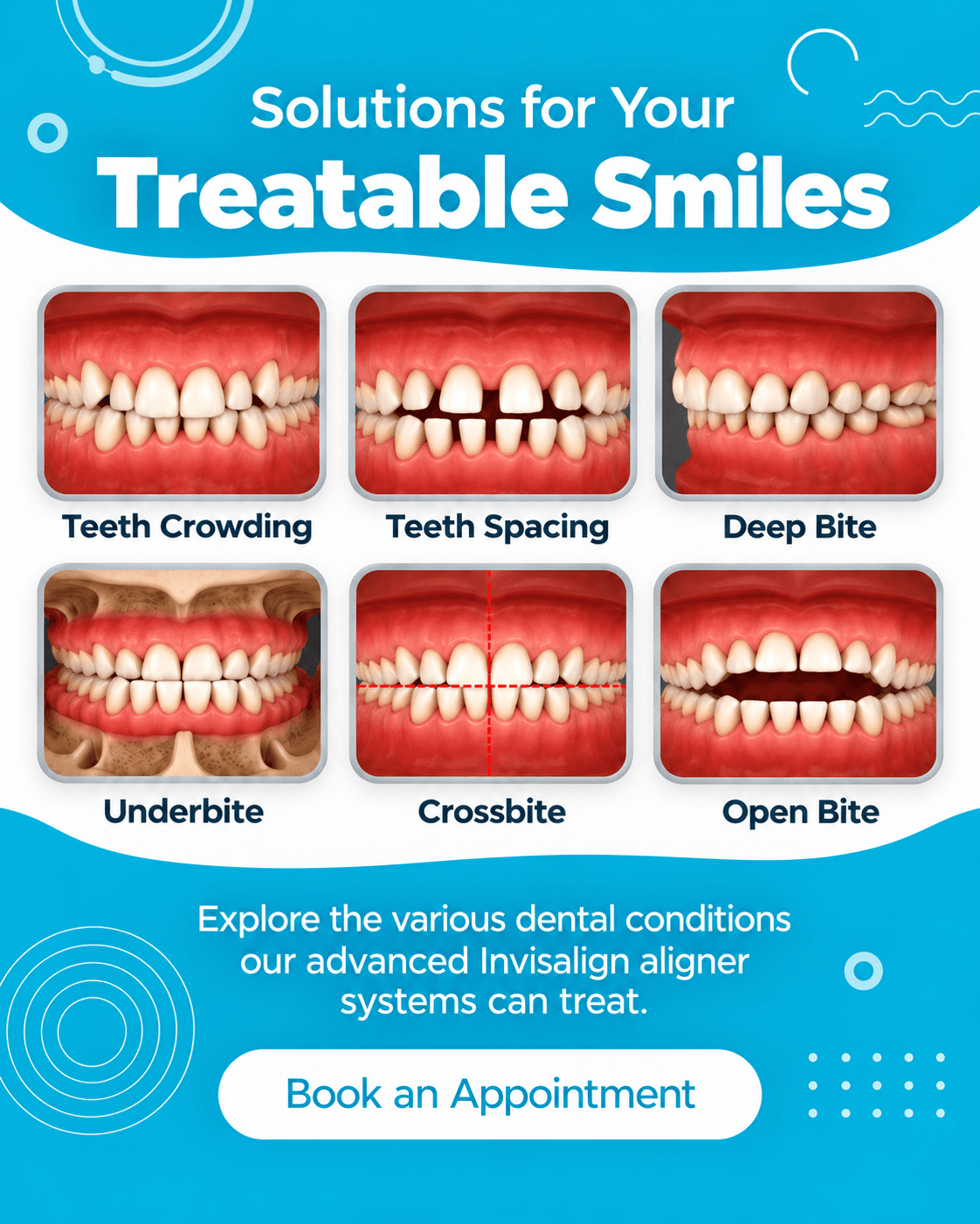Banner 2 for treatable smiles