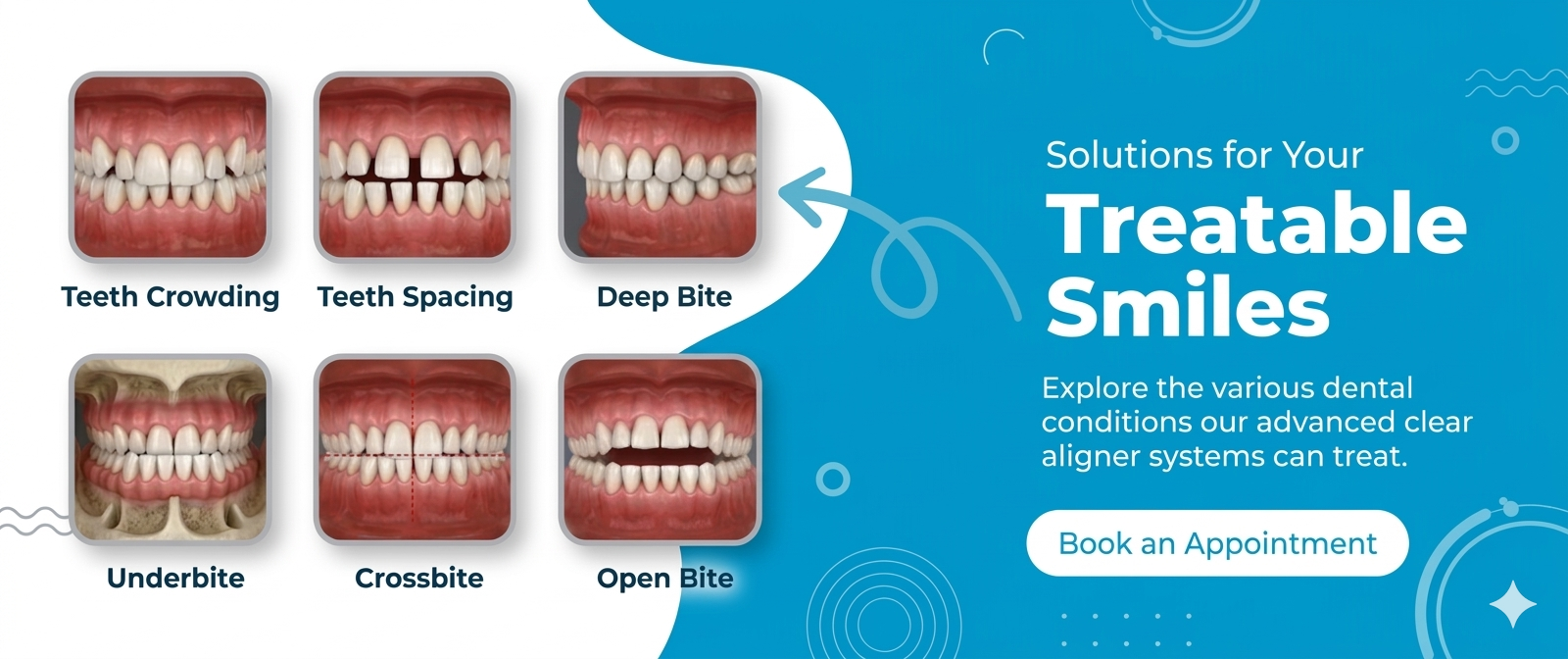 Banner 2 for treatable smiles